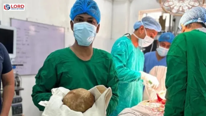 سری لنکا میں ڈاکٹروں نے مریض کے مثانے سے 3 کلو سے زائد وزنی پتھری نکال لی